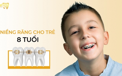 Niềng răng cho trẻ 8 tuổi có quá sớm hay không?