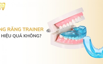 Niềng răng trainer có hiệu quả không? Thời gian niềng trong bao lâu?