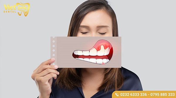 Bệnh lý răng miệng không điều trị dứt điểm