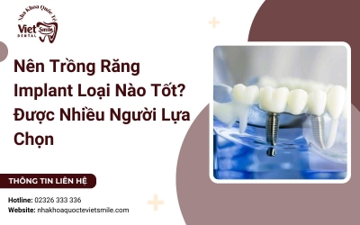 Nên Trồng Răng Implant Loại Nào Tốt? Được Nhiều Người Lựa Chọn