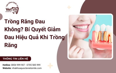 Trồng Răng Đau Không? Bí Quyết Giảm Đau Hiệu Quả Khi Trồng Răng