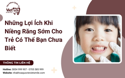 Những Lợi Ích Khi Niềng Răng Sớm Cho Trẻ Có Thể Bạn Chưa Biết