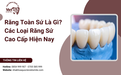 Răng Toàn Sứ Là Gì? Các Loại Răng Sứ Cao Cấp Hiện Nay