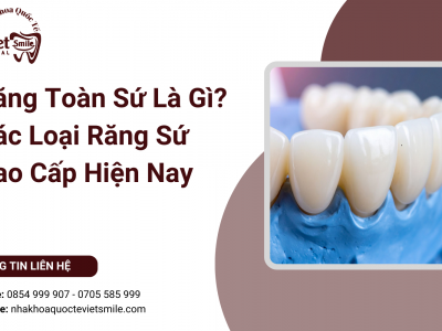 Răng Toàn Sứ Là Gì? Các Loại Răng Sứ Cao Cấp Hiện Nay