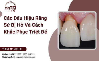 Các Dấu Hiệu Răng Sứ Bị Hở Và Cách Khắc Phục Triệt Để