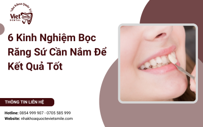 6 Kinh Nghiệm Bọc Răng Sứ Cần Nắm Để Kết Quả Tốt 6 Kinh Nghiệm Bọc Răng Sứ Cần Nắm Để Kết Quả Tốt