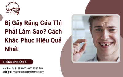 Bị Gãy Răng Cửa Thì Phải Làm Sao? Cách Khắc Phục Hiệu Quả Nhất
