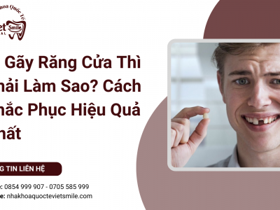 Bị Gãy Răng Cửa Thì Phải Làm Sao? Cách Khắc Phục Hiệu Quả Nhất