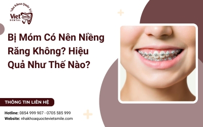 Bị Móm Có Nên Niềng Răng Không? Hiệu Quả Như Thế Nào?