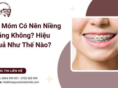 Bị Móm Có Nên Niềng Răng Không? Hiệu Quả Như Thế Nào?