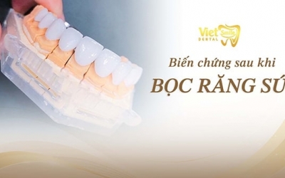 Nguyên nhân gây ra những biến chứng sau khi bọc răng sứ