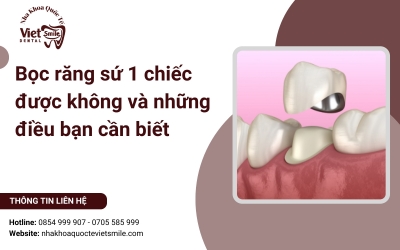 Bọc răng sứ 1 chiếc được không và những điều bạn cần biết