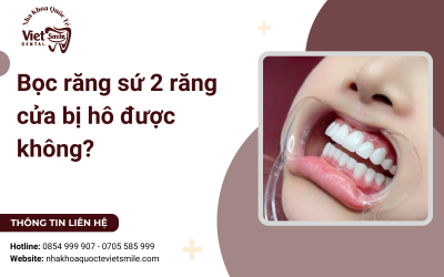Bọc răng sứ 2 răng cửa bị hô được không?