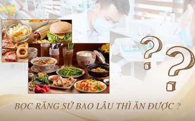 Bọc răng sứ bao lâu thì ăn được bình thường? Cách chăm sóc răng miệng sau khi bọc răng sứ