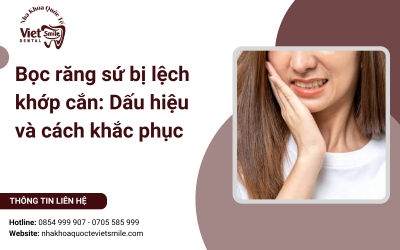 Bọc răng sứ bị lệch khớp cắn: Dấu hiệu và cách khắc phục