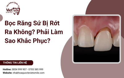 Bọc Răng Sứ Bị Rớt Ra Không? Phải Làm Sao Khắc Phục?