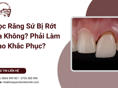 Bọc Răng Sứ Bị Rớt Ra Không? Phải Làm Sao Khắc Phục?