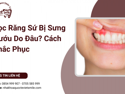 Bọc Răng Sứ Bị Sưng Nướu Do Đâu? Cách Khắc Phục