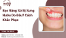 Bọc Răng Sứ Bị Sưng Nướu Do Đâu? Cách Khắc Phục