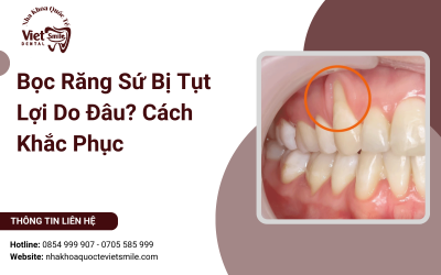 Bọc Răng Sứ Bị Tụt Lợi Do Đâu? Cách Khắc Phục Bọc Răng Sứ Bị Tụt Lợi Do Đâu? Cách Khắc Phục