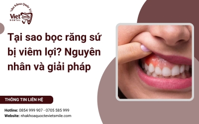 Tại sao bọc răng sứ bị viêm lợi? Nguyên nhân và giải pháp