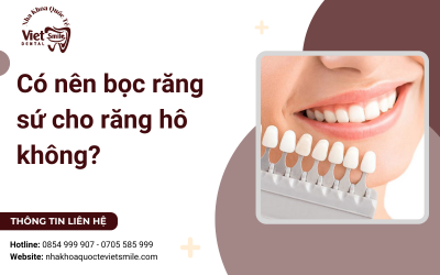Có nên bọc răng sứ cho răng hô không? 