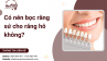 Có nên bọc răng sứ cho răng hô không? 