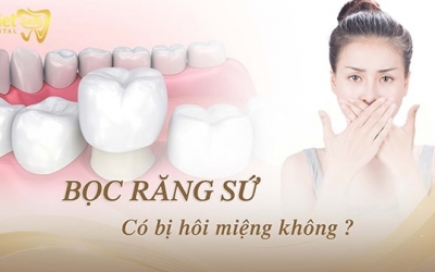 Bọc răng sứ có bị hôi miệng không? Vì sao 