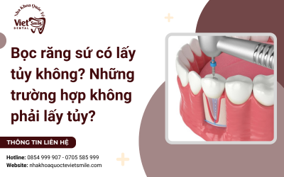 Bọc răng sứ có lấy tủy không? Những trường hợp không phải lấy tủy?