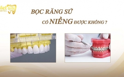 Bọc răng sứ có niềng được không? Khi nào nên bọc răng sứ