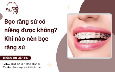 Bọc răng sứ có niềng được không? Khi nào nên bọc răng sứ