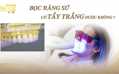 Bọc răng sứ có tẩy trắng được không? Cách làm trắng răng sứ mà bạn nên biết