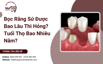 Bọc Răng Sứ Được Bao Lâu Thì Hỏng? Tuổi Thọ Bao Nhiêu Năm?