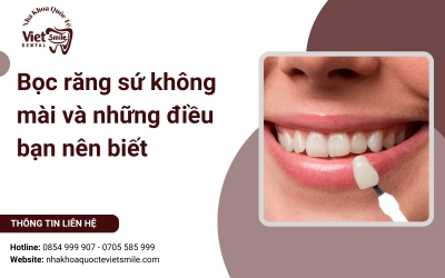 Bọc răng sứ không mài và những điều bạn nên biết