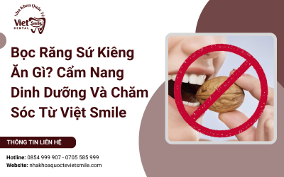 Bọc Răng Sứ Kiêng Ăn Gì? Cẩm Nang Dinh Dưỡng Và Chăm Sóc Từ Việt Smile