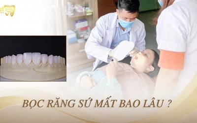 Bọc răng sứ mất bao lâu? Quy trình bọc răng sứ diễn ra như thế nào?