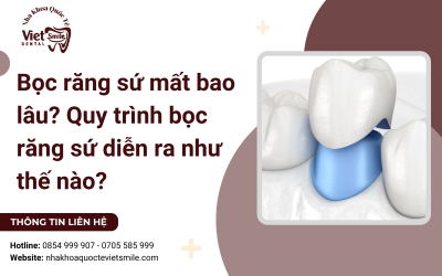 Bọc răng sứ mất bao lâu? Quy trình bọc răng sứ diễn ra như thế nào?