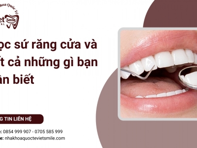 Bọc sứ răng cửa và tất cả những gì bạn cần biết