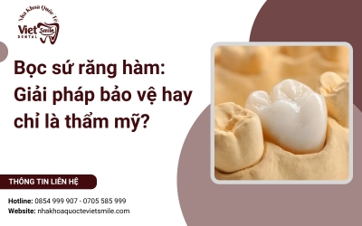 Bọc sứ răng hàm: Giải pháp bảo vệ hay chỉ là thẩm mỹ?