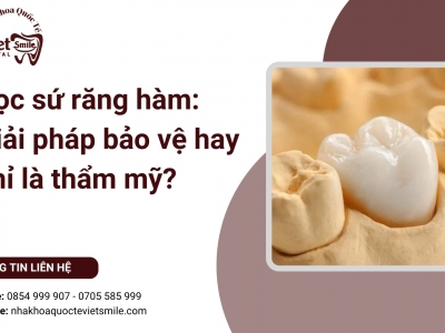 Bọc sứ răng hàm: Giải pháp bảo vệ hay chỉ là thẩm mỹ?