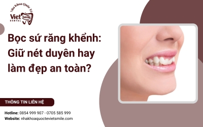 Bọc sứ răng khểnh: Giữ nét duyên hay làm đẹp an toàn?