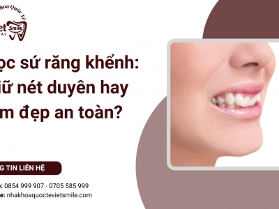 Bọc sứ răng khểnh: Giữ nét duyên hay làm đẹp an toàn?