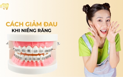 Top 10 cách giảm đau khi niềng răng hiệu quả tại nhà