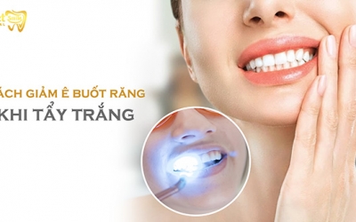 Những cách giảm ê buốt răng khi tẩy trắng mà bạn nên biết