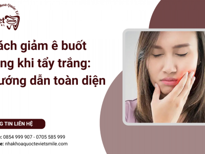 Cách giảm ê buốt răng khi tẩy trắng: Hướng dẫn toàn diện