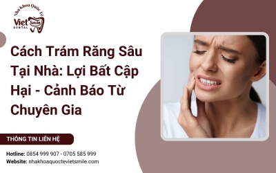 Cách Trám Răng Sâu Tại Nhà: Lợi Bất Cập Hại - Cảnh Báo Từ Chuyên Gia