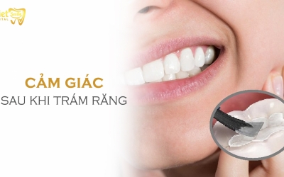 Cảm giác sau khi trám răng bị ê buốt: Nguyên nhân và cách khắc phục