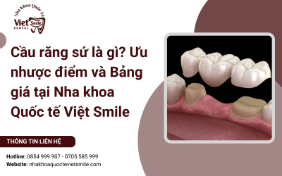 Cầu răng sứ là gì? Ưu nhược điểm và Bảng giá tại Nha khoa Quốc tế Việt Smile