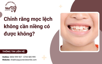 Chỉnh răng mọc lệch không cần niềng có được không?