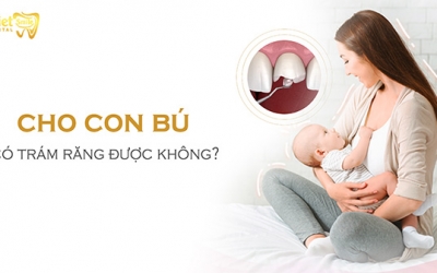 Cho con bú có trám răng được không?